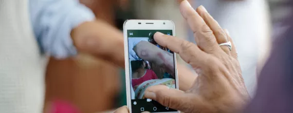 Person taking photo with its mobile phone of a leprosy lesion for AI-enabled and accelerated leprosy detection