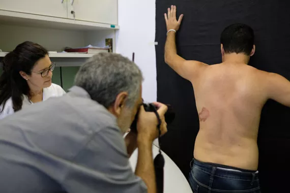 Man with leprosy lesion on his back faces a wall while another man photographs the lesion to support a diagnostic tool