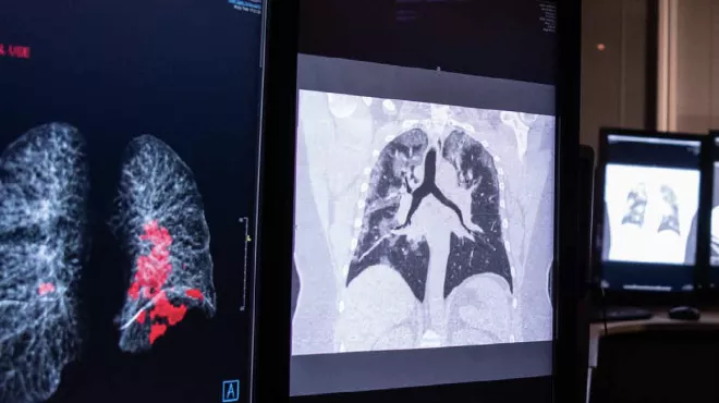 Pursuing AI maturity in health
